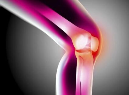 Deform arthrosis
