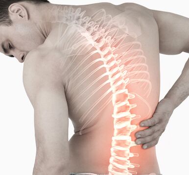 Backache