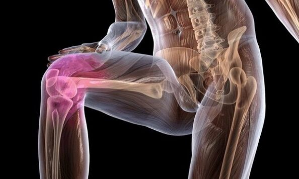 Signs and symptoms of arthrosis of the knee joint