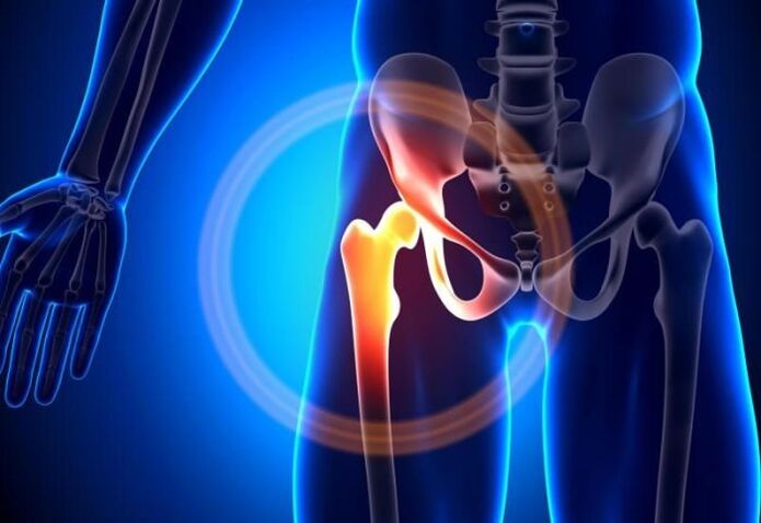 hip pain